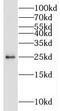EEF1A Lysine Methyltransferase 1 antibody, FNab05533, FineTest, Western Blot image 