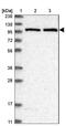 Alanyl-tRNA synthetase, mitochondrial antibody, NBP1-89323, Novus Biologicals, Western Blot image 