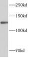 ALG13 UDP-N-Acetylglucosaminyltransferase Subunit antibody, FNab00306, FineTest, Western Blot image 