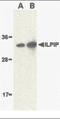 STE20 Related Adaptor Beta antibody, orb86536, Biorbyt, Western Blot image 