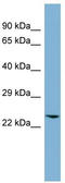 Glyoxalase I antibody, TA334412, Origene, Western Blot image 