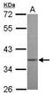 Methyl-CpG Binding Domain Protein 3 antibody, GTX116204, GeneTex, Western Blot image 