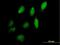 Inositol-Pentakisphosphate 2-Kinase antibody, H00064768-B01P, Novus Biologicals, Immunofluorescence image 