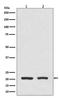Dihydrofolate Reductase antibody, M00813, Boster Biological Technology, Western Blot image 
