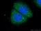 Ras-related protein Rab-35 antibody, 11329-2-AP, Proteintech Group, Immunofluorescence image 