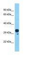 Olfactory Receptor Family 4 Subfamily C Member 45 (Gene/Pseudogene) antibody, orb327052, Biorbyt, Western Blot image 
