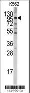 Leucine Rich Repeat Containing G Protein-Coupled Receptor 5 antibody, MBS9205024, MyBioSource, Western Blot image 