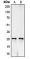 CA1 antibody, orb213626, Biorbyt, Western Blot image 