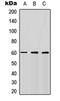 Bone Morphogenetic Protein Receptor Type 1A antibody, orb235049, Biorbyt, Western Blot image 
