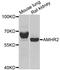 Anti-Mullerian Hormone Receptor Type 2 antibody, A6523, ABclonal Technology, Western Blot image 