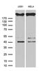 A-Kinase Anchoring Protein 12 antibody, M02303, Boster Biological Technology, Western Blot image 