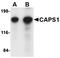 Opioid Receptor Mu 1 antibody, orb6275, Biorbyt, Western Blot image 