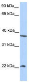 Serine/threonine-protein kinase Nek7 antibody, TA329575, Origene, Western Blot image 