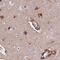 Neuronal Cell Adhesion Molecule antibody, FNab05852, FineTest, Immunohistochemistry paraffin image 