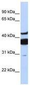 Ceramide Synthase 2 antibody, TA330626, Origene, Western Blot image 