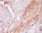 Complement component C9 antibody, M01010, Boster Biological Technology, Immunohistochemistry paraffin image 