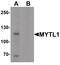Myelin transcription factor 1-like protein antibody, PA5-34468, Invitrogen Antibodies, Western Blot image 