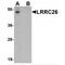 Leucine Rich Repeat Containing 26 antibody, TA326675, Origene, Western Blot image 