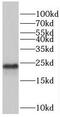 Peroxiredoxin 2 antibody, FNab06319, FineTest, Western Blot image 