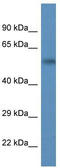 Proteasome 26S Subunit, ATPase 1 antibody, TA342172, Origene, Western Blot image 