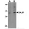 Spindle And Kinetochore Associated Complex Subunit 1 antibody, MBS150085, MyBioSource, Western Blot image 