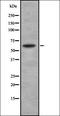 Sterol O-acyltransferase 1 antibody, orb336833, Biorbyt, Western Blot image 