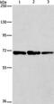 Phenylalanyl-tRNA synthetase beta chain antibody, PA5-50334, Invitrogen Antibodies, Western Blot image 