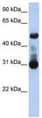 Activin A Receptor Like Type 1 antibody, TA334641, Origene, Western Blot image 