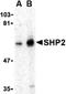 Protein Tyrosine Phosphatase Non-Receptor Type 11 antibody, orb86740, Biorbyt, Western Blot image 