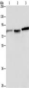 Dopamine Beta-Hydroxylase antibody, TA349869, Origene, Western Blot image 