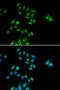 Polyhomeotic Homolog 3 antibody, GTX32785, GeneTex, Immunocytochemistry image 