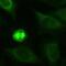 Keratin 19 antibody, PA3-16834, Invitrogen Antibodies, Immunofluorescence image 