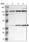Ribosomal RNA-processing protein 7 homolog A antibody, HPA001586, Atlas Antibodies, Western Blot image 