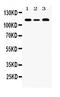 Helicase Like Transcription Factor antibody, PB10070, Boster Biological Technology, Western Blot image 