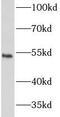 Interferon alpha/beta receptor 2 antibody, FNab04148, FineTest, Western Blot image 
