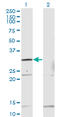 Homeobox B1 antibody, LS-C139493, Lifespan Biosciences, Western Blot image 