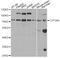 Cytochrome P450 Family 3 Subfamily A Member 4 antibody, STJ23326, St John