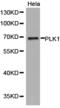 Polo Like Kinase 1 antibody, TA327377, Origene, Western Blot image 