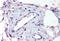 ADAM Metallopeptidase With Thrombospondin Type 1 Motif 1 antibody, MBS241500, MyBioSource, Immunohistochemistry frozen image 