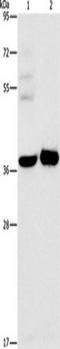 Serpin Family E Member 2 antibody, TA349425, Origene, Western Blot image 