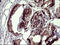 BH3 Interacting Domain Death Agonist antibody, M00730-2, Boster Biological Technology, Immunohistochemistry paraffin image 