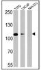 Androgen Receptor antibody, GTX22742, GeneTex, Western Blot image 