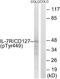 Interleukin 7 Receptor antibody, P30449, Boster Biological Technology, Western Blot image 