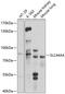 SLC44A4 antibody, A08008, Boster Biological Technology, Western Blot image 