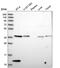 Coagulation Factor VIII Associated 3 antibody, HPA046960, Atlas Antibodies, Western Blot image 