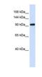 Zinc Finger BED-Type Containing 9 antibody, NBP1-79265, Novus Biologicals, Western Blot image 