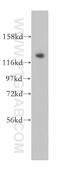 Cell Division Cycle Associated 2 antibody, 17701-1-AP, Proteintech Group, Western Blot image 