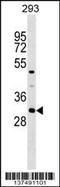 Ankyrin Repeat And SOCS Box Containing 7 antibody, 59-617, ProSci, Western Blot image 