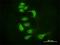 Argonaute RISC Catalytic Component 2 antibody, H00027161-M01, Novus Biologicals, Immunocytochemistry image 
