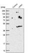 Uracil Phosphoribosyltransferase Homolog antibody, NBP1-87979, Novus Biologicals, Western Blot image 